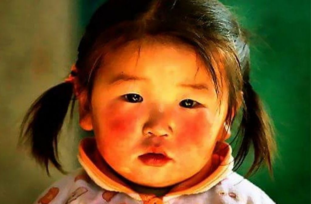 Neden "Elma Gibi Kırmızı Yanaklı" Denir? Neden "Elma Gibi Kırmızı Yanaklı" Denir?